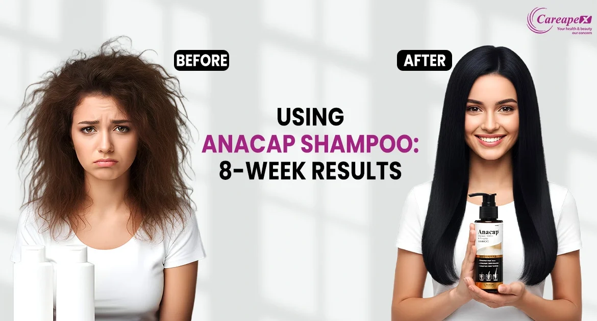Anacap Shampoo